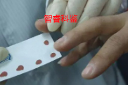 血痕样本采集方法