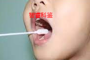 口腔拭子样本采集方法