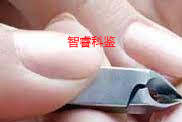指甲样本采集方法