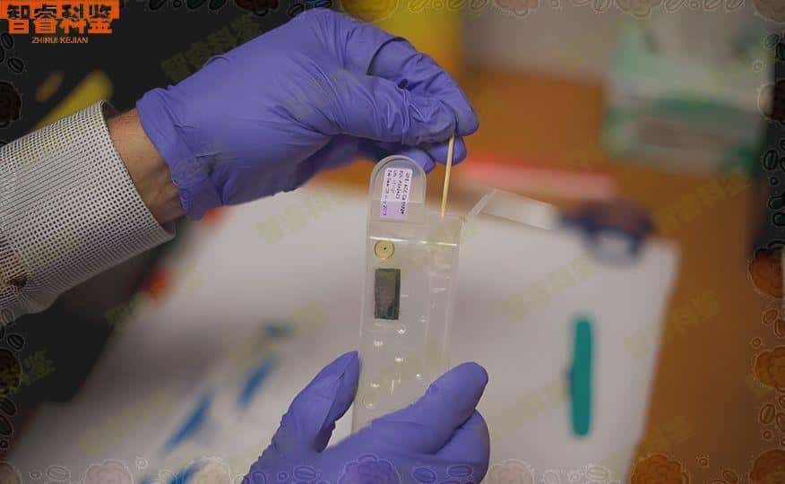 宜都可以做亲子鉴定的正规医院