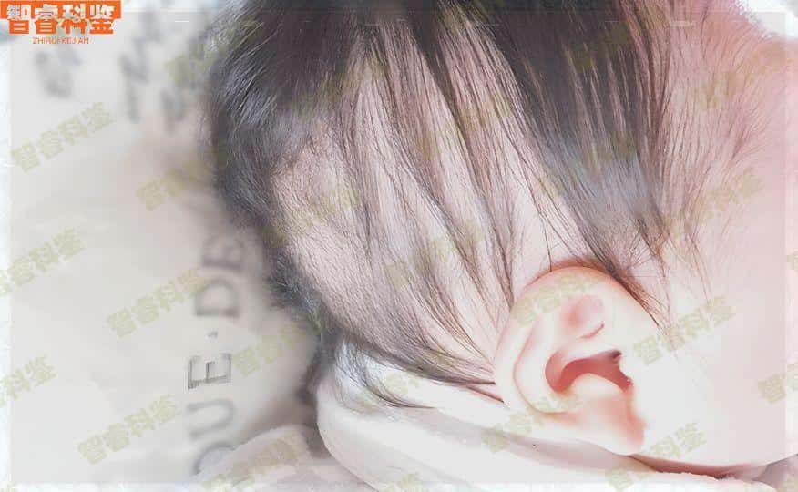 海拉尔区医院亲子鉴定